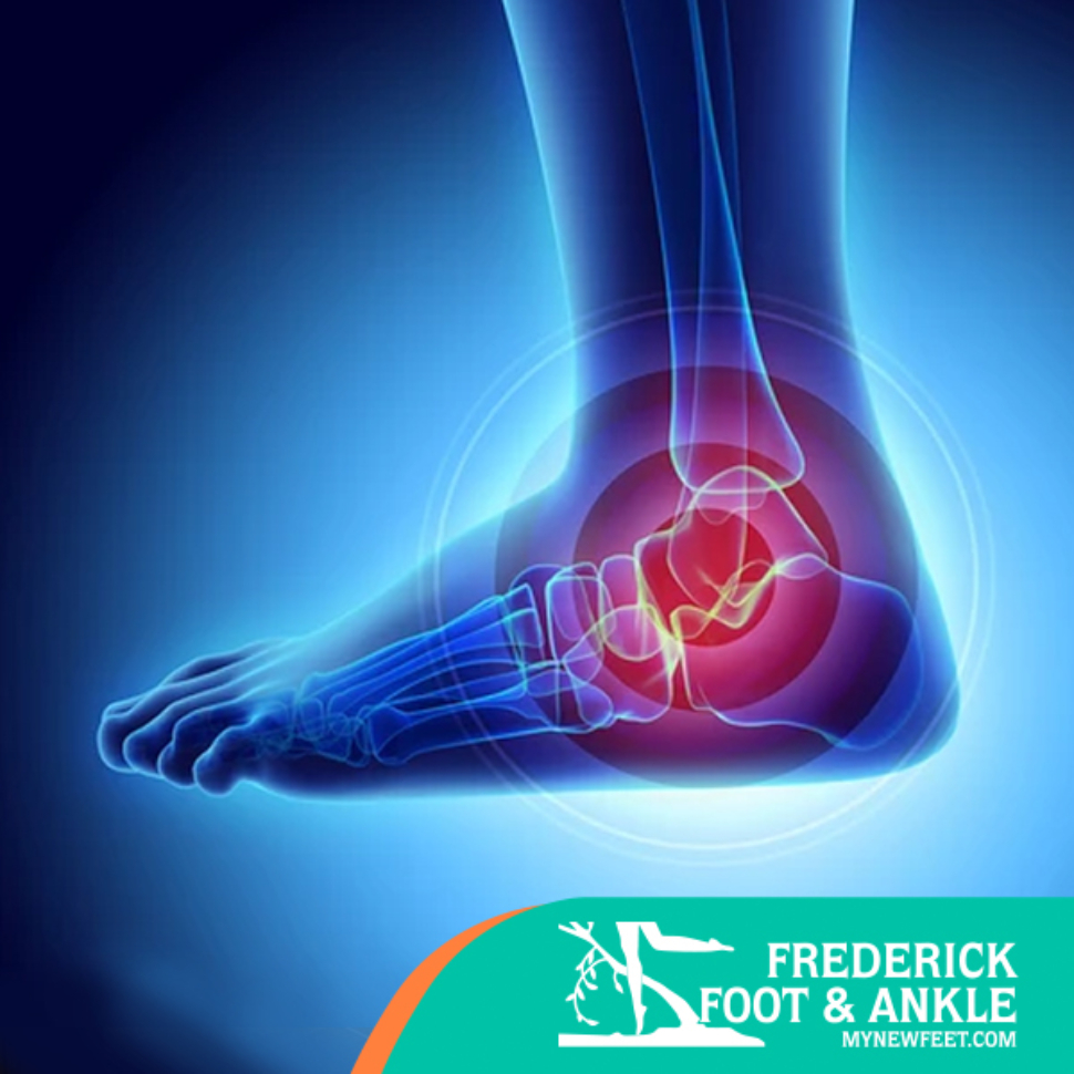 Featured_BrokenAnkle